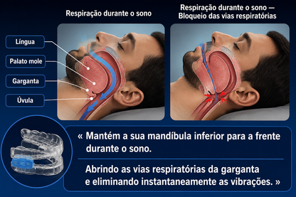 Órtese de avanço mandibular anti-ronco zaxx
