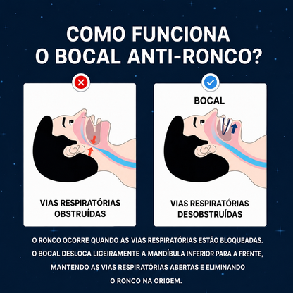 Órtese de avanço mandibular anti-ronco zaxx